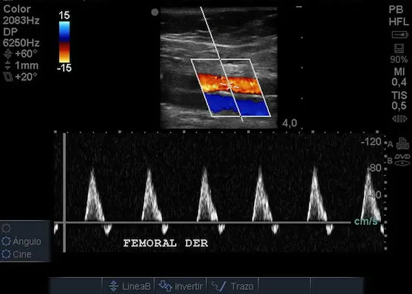 imagen de ecografía de miembros inferiores.
